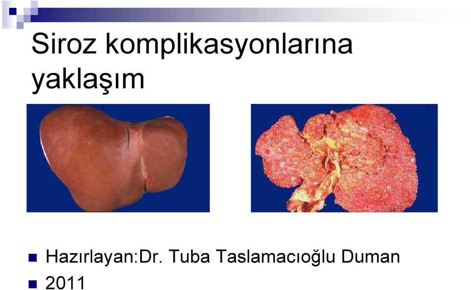 yaklaşım