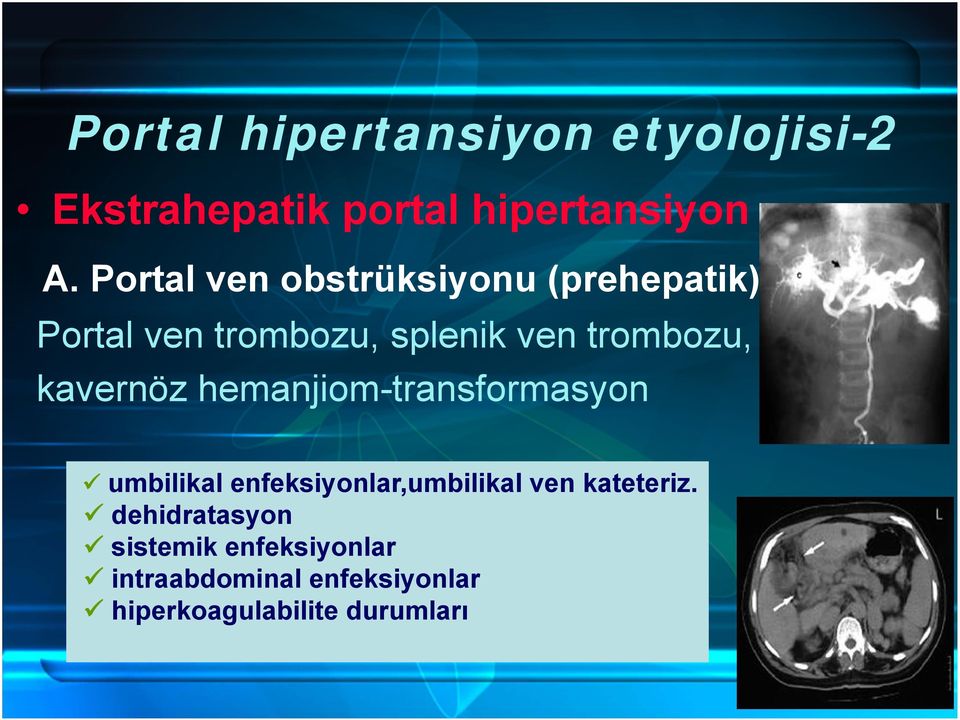 kavernöz hemanjiom-transformasyon umbilikal enfeksiyonlar,umbilikal ven kateteriz.