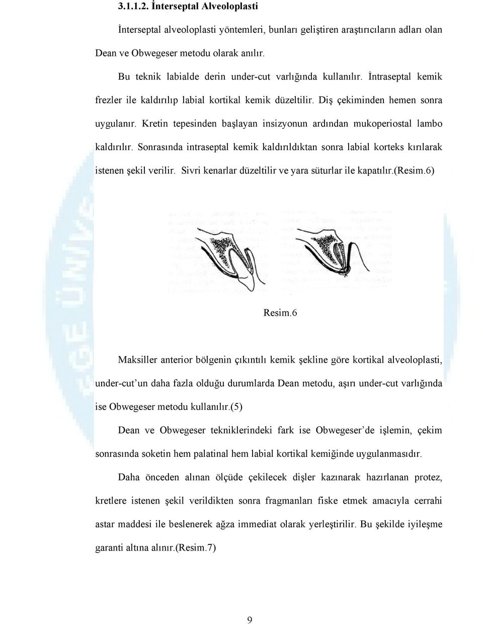 Kretin tepesinden başlayan insizyonun ardından mukoperiostal lambo kaldırılır. Sonrasında intraseptal kemik kaldırıldıktan sonra labial korteks kırılarak istenen şekil verilir.