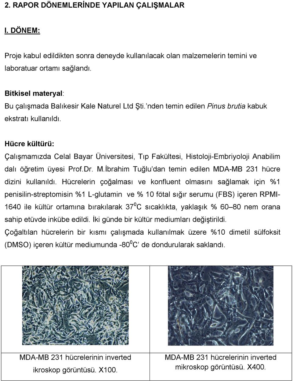 Hücre kültürü: Çalışmamızda Celal Bayar Üniversitesi, Tıp Fakültesi, Histoloji-Embriyoloji Anabilim dalı öğretim üyesi Prof.Dr. M.İbrahim Tuğlu dan temin edilen MDA-MB 231 hücre dizini kullanıldı.