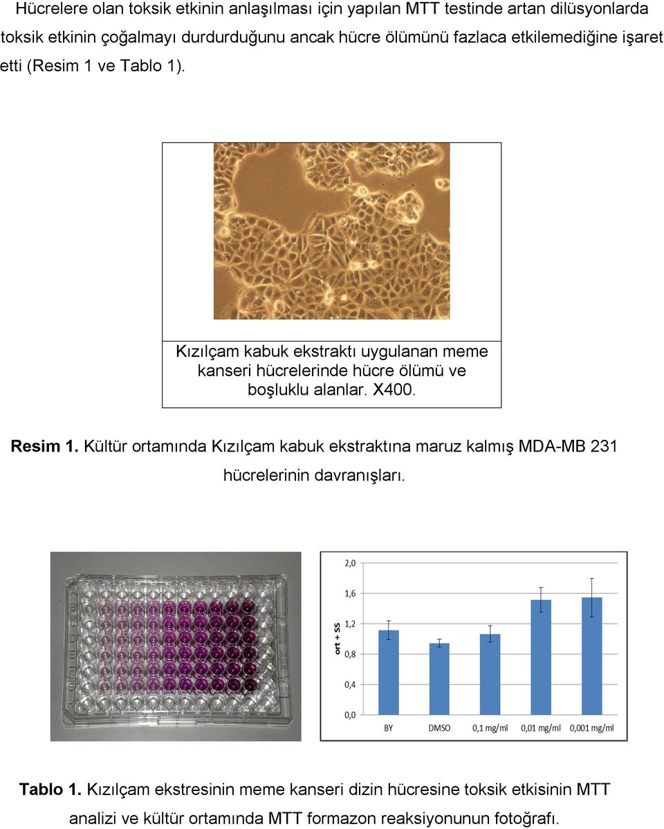 Kızılçam kabuk ekstraktı uygulanan meme kanseri hücrelerinde hücre ölümü ve boşluklu alanlar. X400. Resim 1.