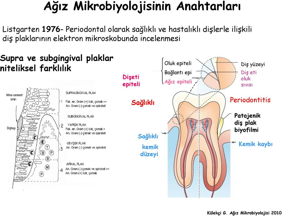 plaklar niteliksel farklılık DiĢeti epiteli Oluk epiteli Bağlantı epi Ağız epiteli Diş yüzeyi