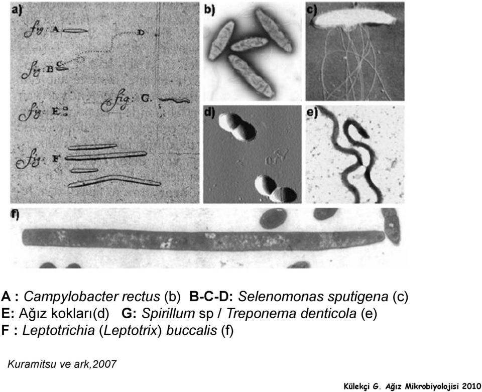 G: Spirillum sp / Treponema denticola (e) F :