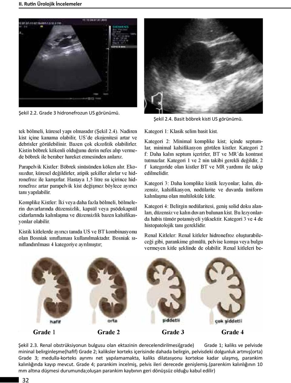 Kistin böbrek kökenli olduğunu derin nefes alıp vermede böbrek ile beraber hareket etmesinden anlarız. Parapelvik Kistler: Böbrek sinüsünden köken alır.