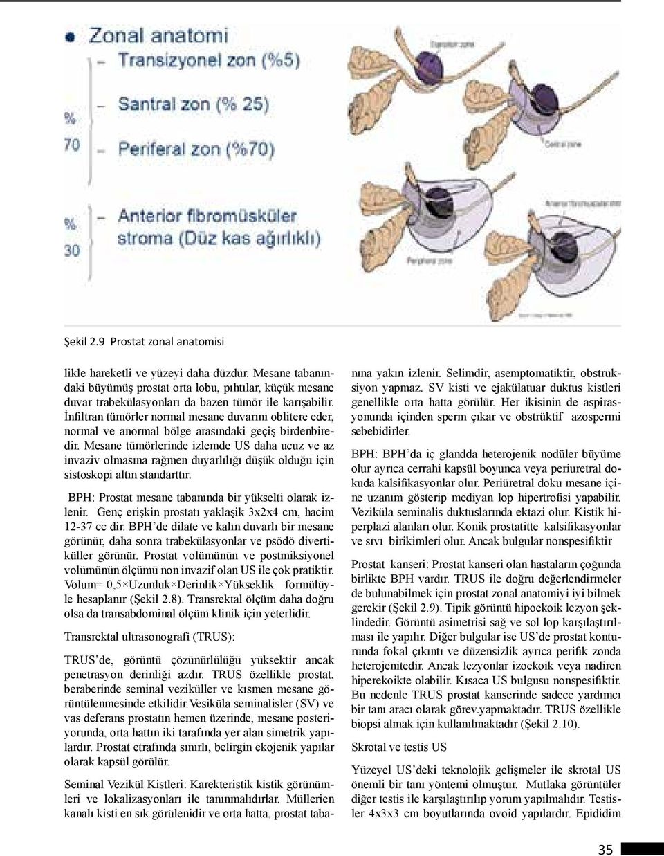 Mesane tümörlerinde izlemde US daha ucuz ve az invaziv olmasına rağmen duyarlılığı düşük olduğu için sistoskopi altın standarttır. BPH: Prostat mesane tabanında bir yükselti olarak izlenir.