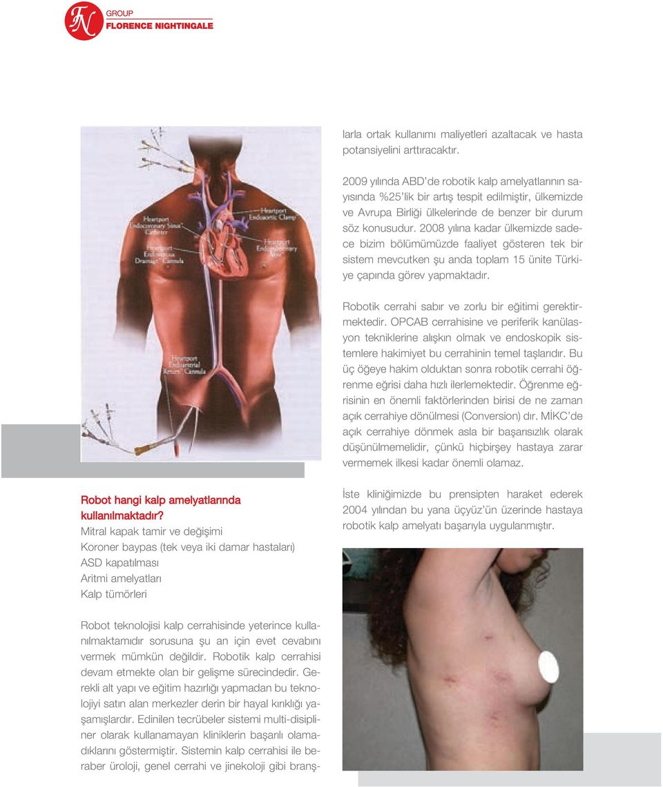 2008 y l na kadar ülkemizde sadece bizim bölümümüzde faaliyet gösteren tek bir sistem mevcutken flu anda toplam 15 ünite Türkiye çap nda görev yapmaktad r.