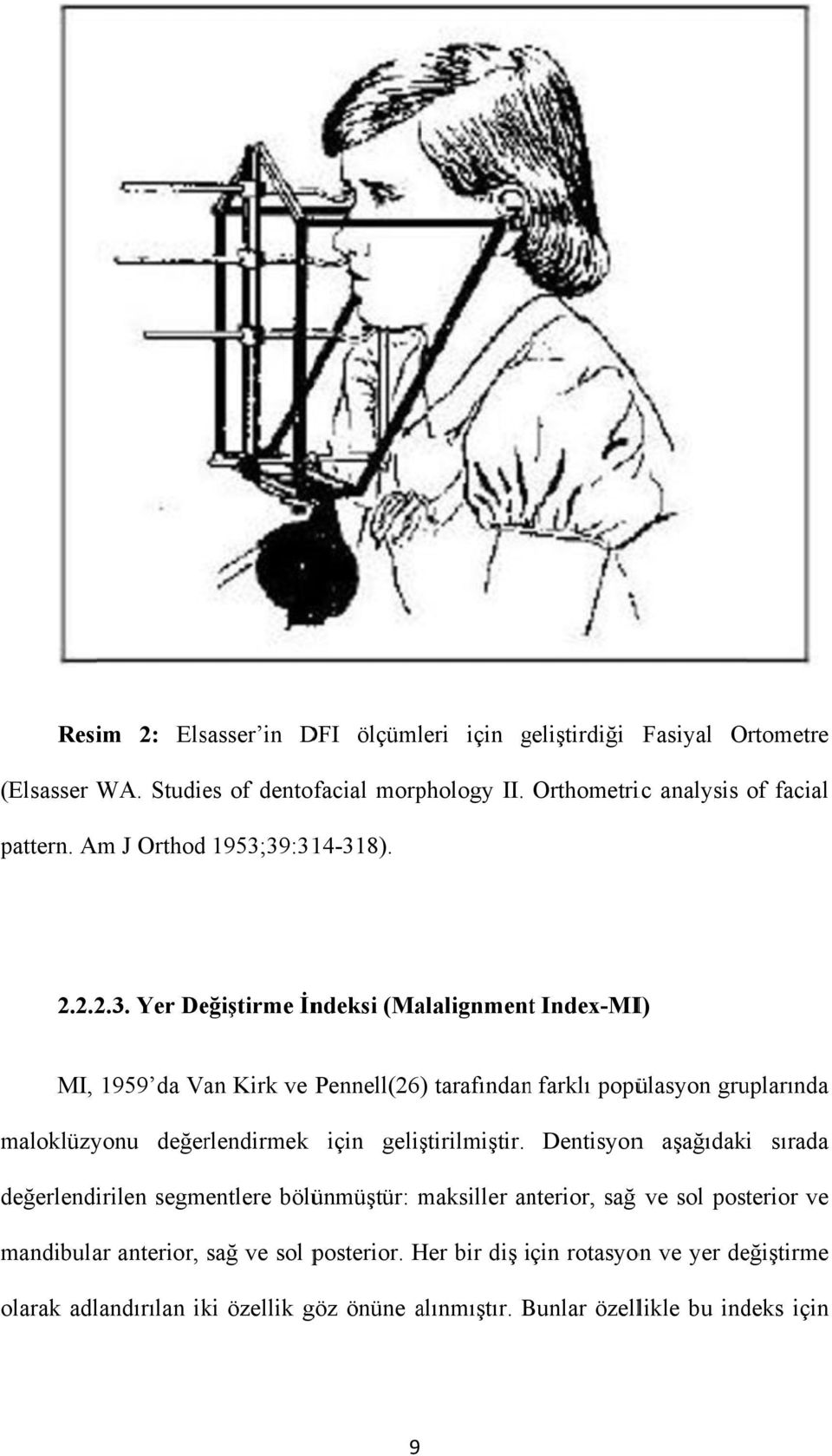 39:314-318). 2.2.2.3. Yer Değiştirme İndeksi (Malalignmentt Index-MI) MI, 1959 da Van Kirk ve Pennell(26) tarafındann farklı popülasyon gruplarında maloklüzyonu