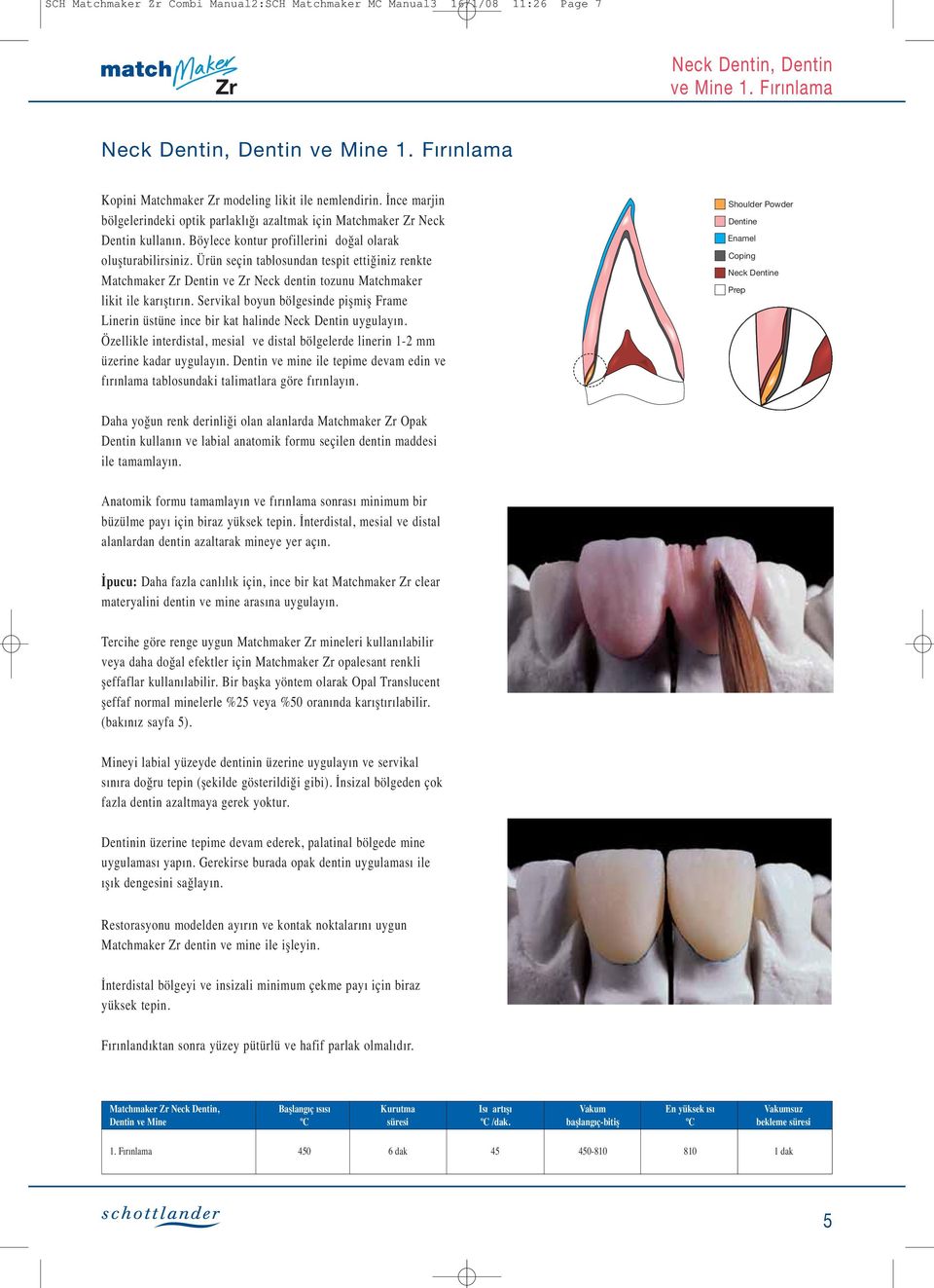 Böylece kontur profillerini doğal olarak oluşturabilirsiniz. Ürün seçin tablosundan tespit ettiğiniz renkte Matchmaker Dentin ve Neck dentin tozunu Matchmaker likit ile karıştırın.