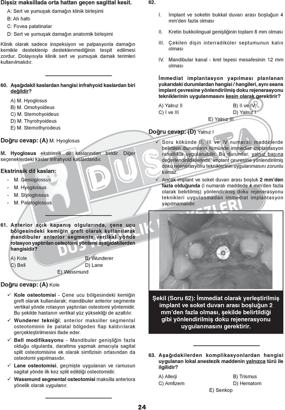 desteklenmediğinin tespit edilmesi zordur. Dolayısıyla klinik sert ve yumuşak damak terimleri kullanılmalıdır. 62. I. İmplant ve soketin bukkal duvarı arası boşluğun 4 mm den fazla olması II.