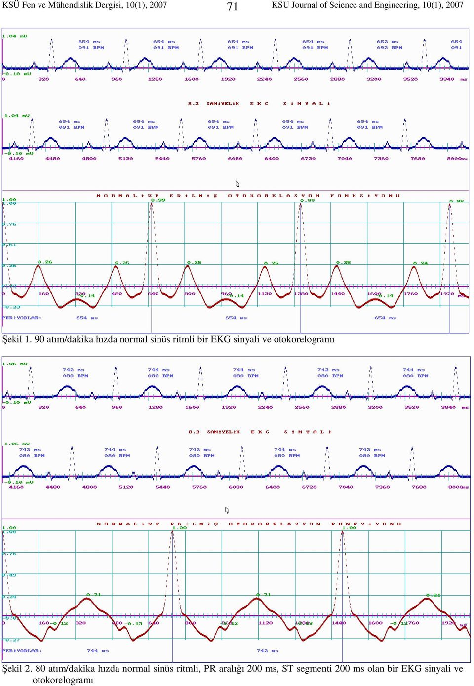 90 atım/dakika hızda normal sinüs ritmli bir EKG sinyali ve otokorelogramı