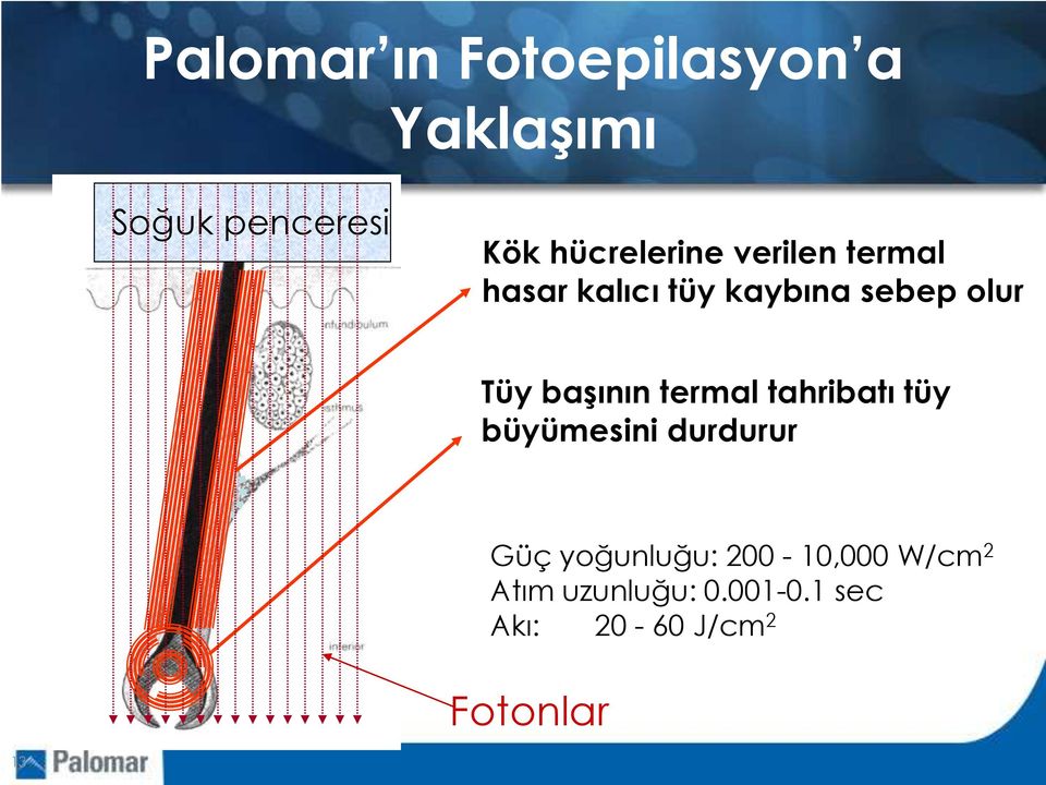 Tüy başının termal tahribatı tüy büyümesini durdurur Güç