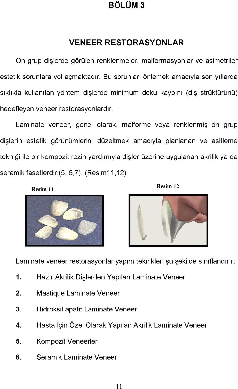 Laminate veneer, genel olarak, malforme veya renklenmiş ön grup dişlerin estetik görünümlerini düzeltmek amacıyla planlanan ve asitleme tekniği ile bir kompozit rezin yardımıyla dişler üzerine