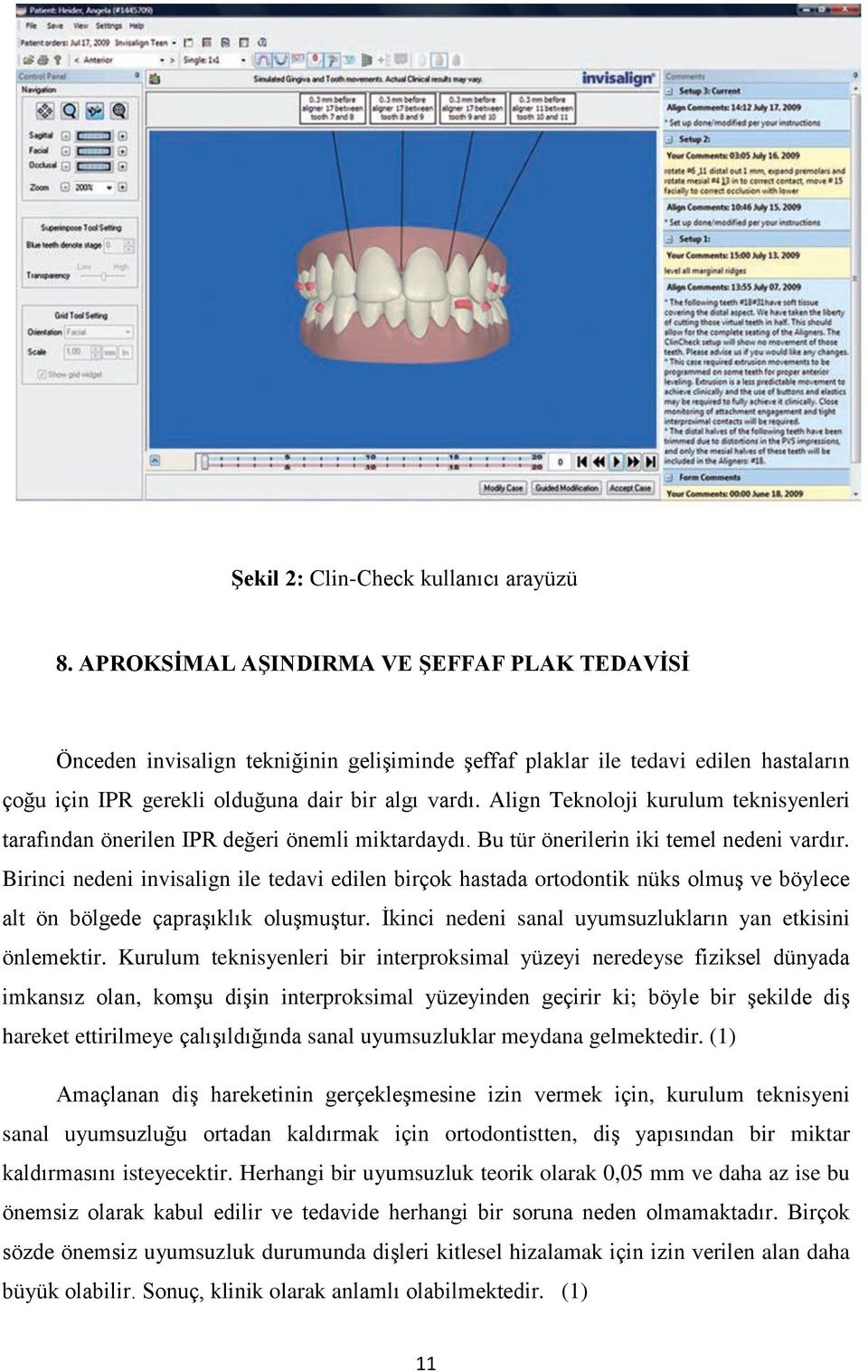 Align Teknoloji kurulum teknisyenleri tarafından önerilen IPR değeri önemli miktardaydı. Bu tür önerilerin iki temel nedeni vardır.