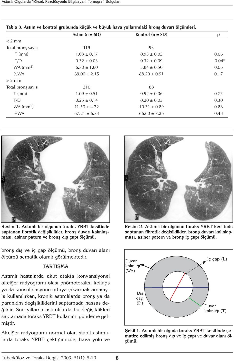 20 ± 0.91 0.17 > 2 mm Total bronş sayısı 310 88 T (mm) 1.09 ± 0.51 0.92 ± 0.06 0.75 T/D 0.25 ± 0.14 0.20 ± 0.03 0.30 WA (mm 2 ) 11.50 ± 4.72 10.31 ± 0.89 0.88 %WA 67.21 ± 6.73 66.60 ± 7.26 0.