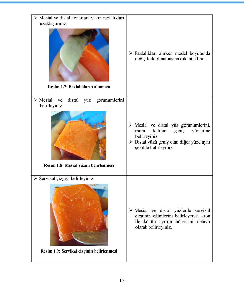 Mesial ve distal yüz görünümlerini, mum kalıbın geniģ yüzlerine belirleyiniz. Distal yüzü geniģ olan diğer yüze aynı Ģekilde belirleyiniz. Resim 1.