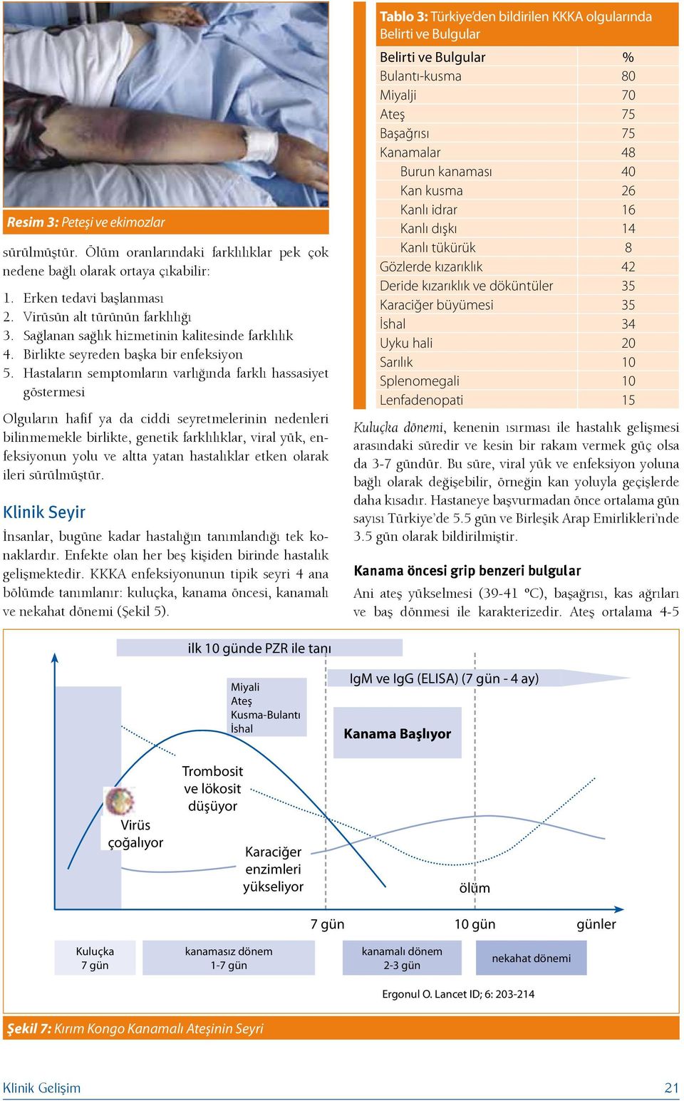 Hastaların semptomların varlığında farklı hassasiyet göstermesi Olguların hafif ya da ciddi seyretmelerinin nedenleri bilinmemekle birlikte, genetik farklılıklar, viral yük, enfeksiyonun yolu ve