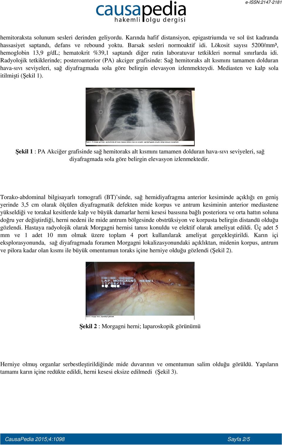 Radyolojik tetkiklerinde; posteroanterior (PA) akciger grafisinde: Sağ hemitoraks alt kısmını tamamen dolduran hava-sıvı seviyeleri, sağ diyafragmada sola göre belirgin elevasyon izlenmekteydi.