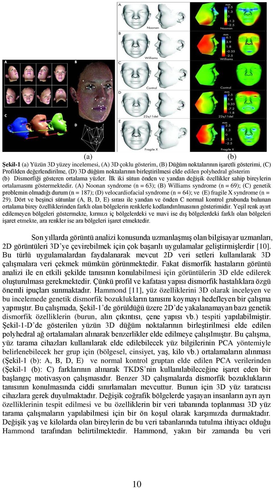 (A) Noonan syndrome (n = 63); (B) Williams syndrome (n = 69); (C) genetik problemin olmadığı durum (n = 187); (D) velocardiofacial syndrome (n = 64); ve (E) fragile X syndrome (n = 29).