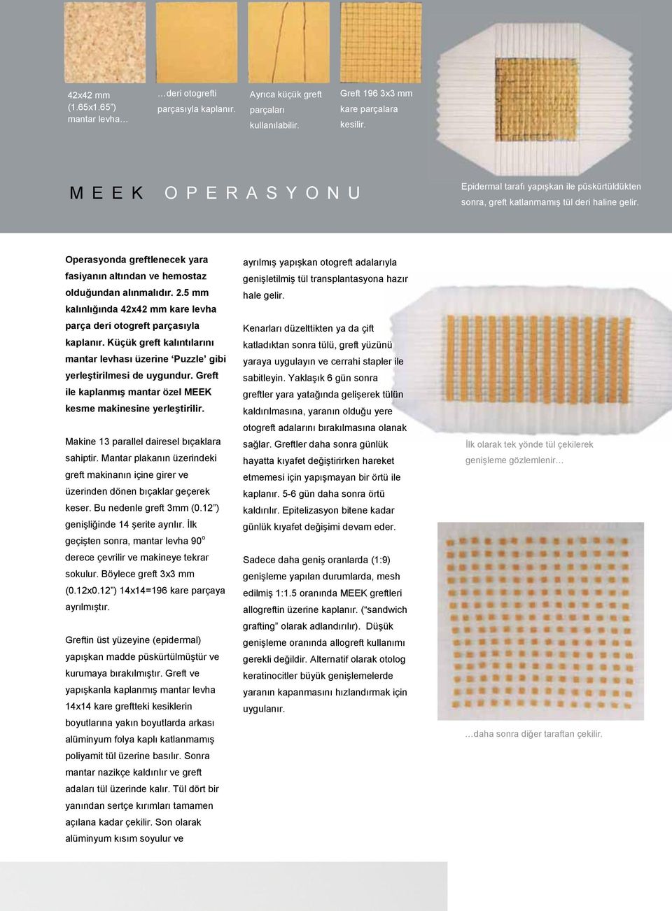 Operasyonda greftlenecek yara fasiyanın altından ve hemostaz olduğundan alınmalıdır. 2.5 mm kalınlığında 42x42 mm kare levha parça deri otogreft parçasıyla kaplanır.