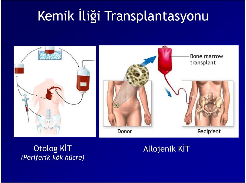 Otolog KİT