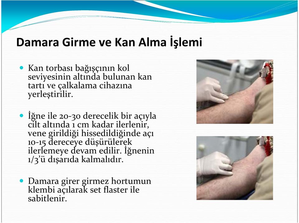 İğne ile 20-30 derecelik bir açıyla cilt altında 1 cm kadar ilerlenir, vene girildiği