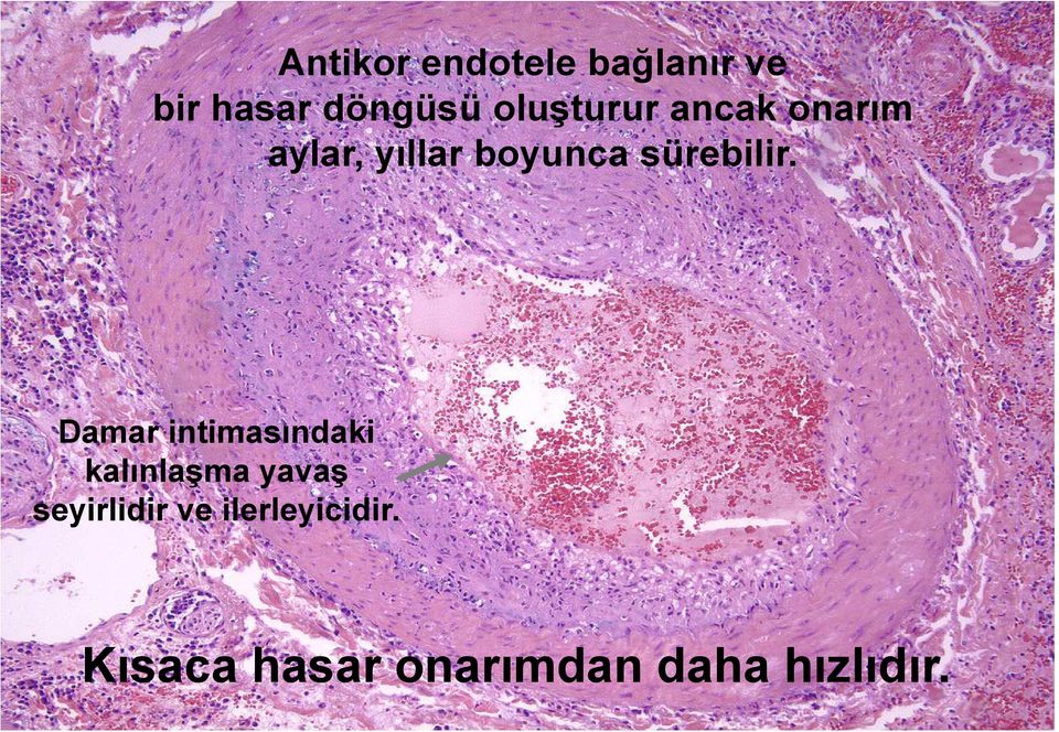 sürebilir.