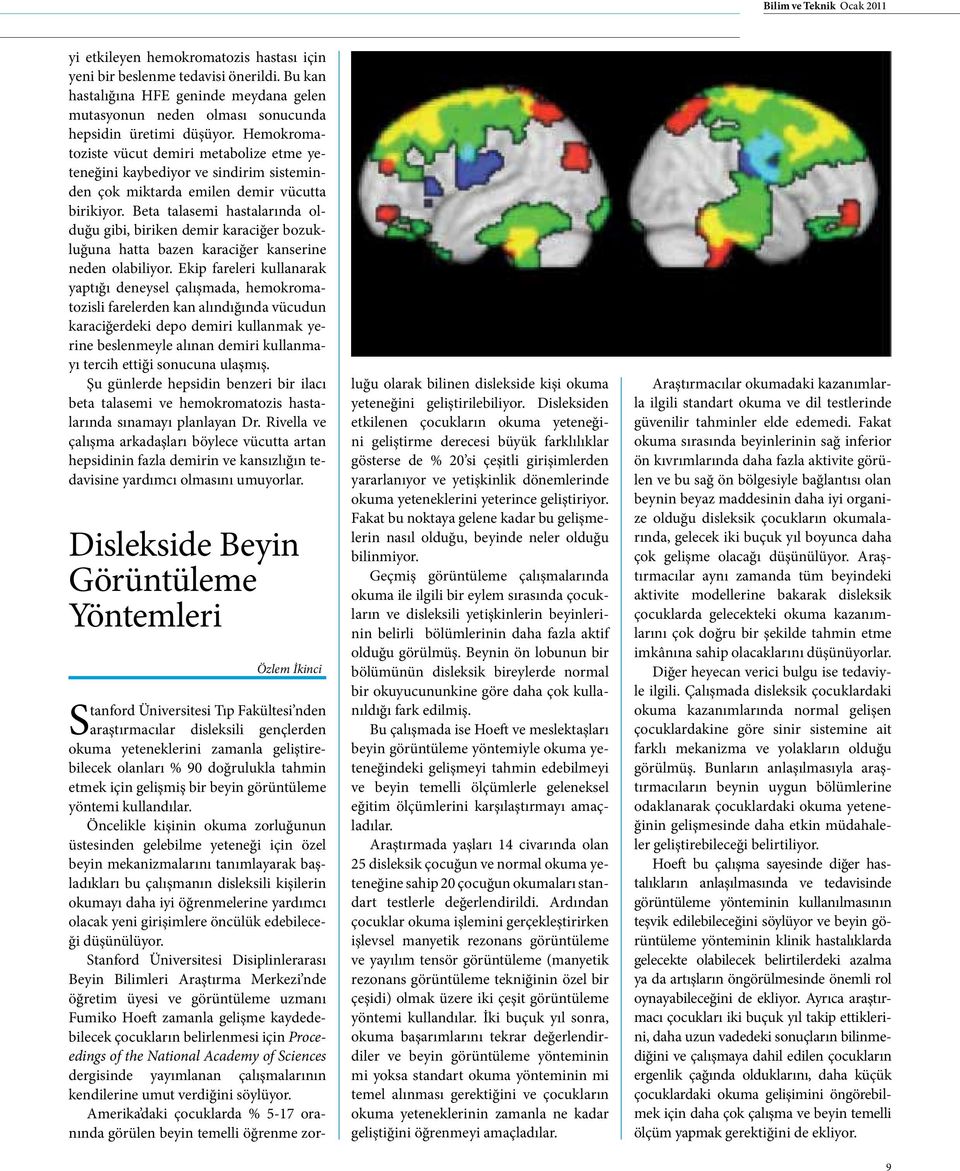 Hemokromatoziste vücut demiri metabolize etme yeteneğini kaybediyor ve sindirim sisteminden çok miktarda emilen demir vücutta birikiyor.