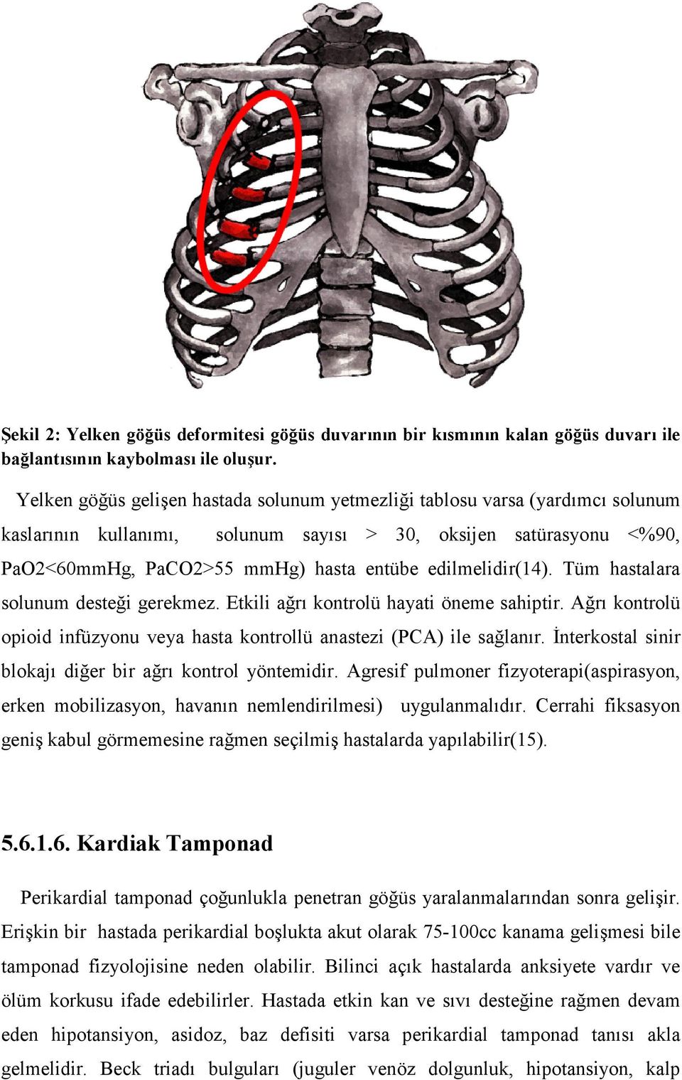 edilmelidir(14). Tüm hastalara solunum desteği gerekmez. Etkili ağrı kontrolü hayati öneme sahiptir. Ağrı kontrolü opioid infüzyonu veya hasta kontrollü anastezi (PCA) ile sağlanır.