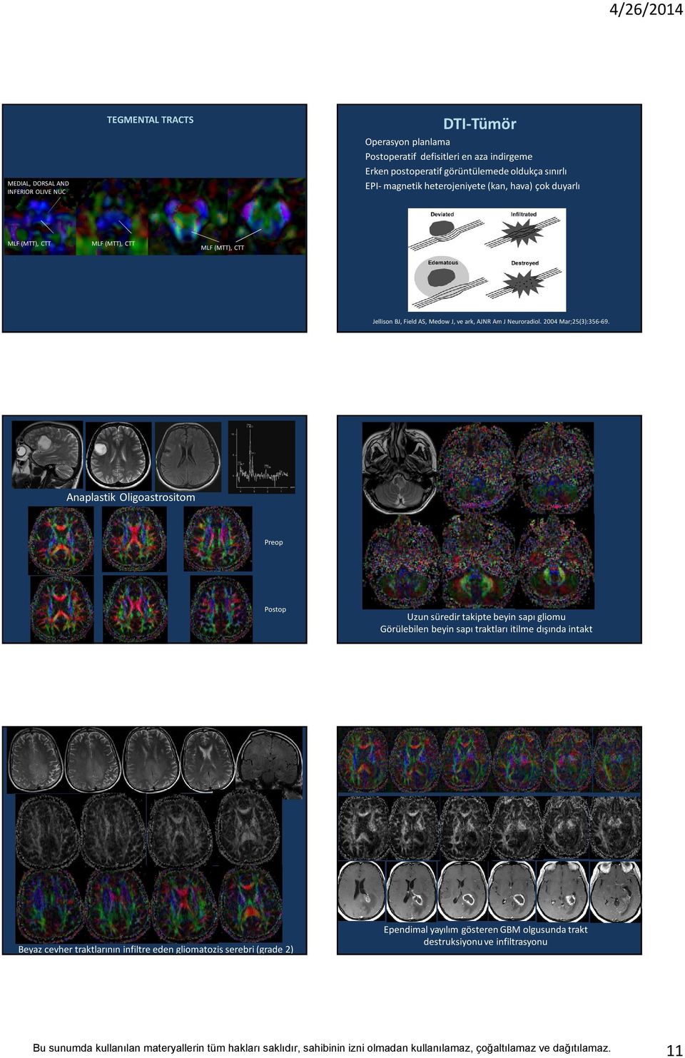 Neuroradiol. 2004 Mar;25(3):356-69.