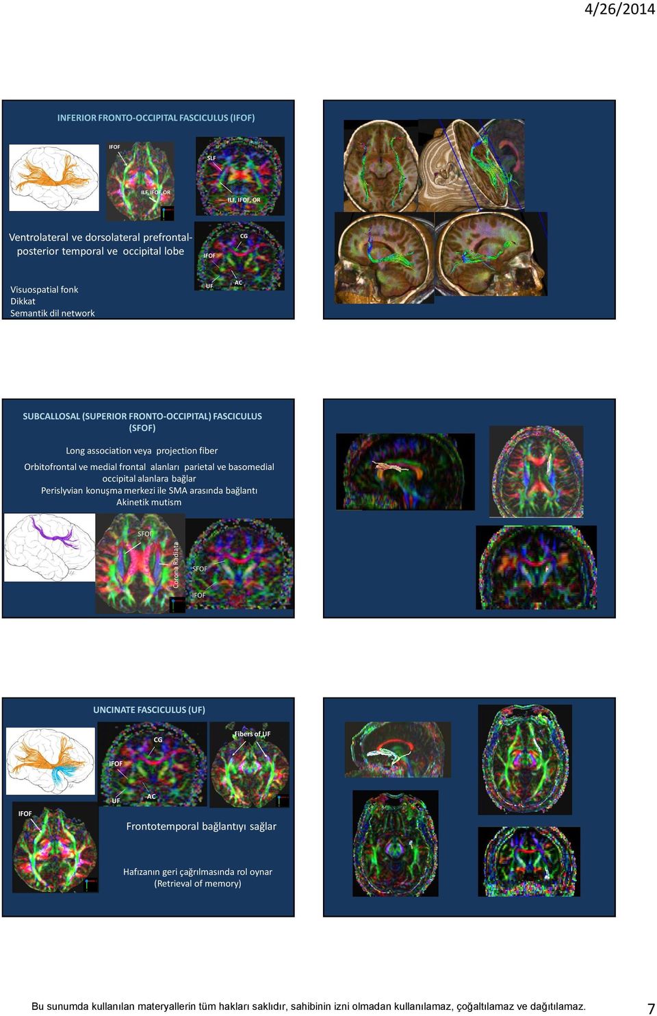 medial frontal alanları parietal ve basomedial occipital alanlara bağlar Perislyvian konuşma merkezi ile SM arasında bağlantı kinetik mutism SFOF Corona