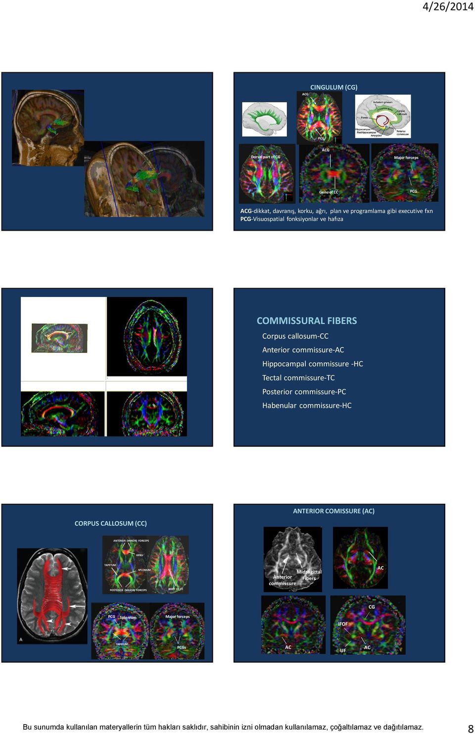 -HC Tectal commissure-tc Posterior commissure-pc Habenular commissure-hc COPUS COSUM (CC) NTEIO COMISSUE (C) NTEIO (MINO) FOCEPS GENU