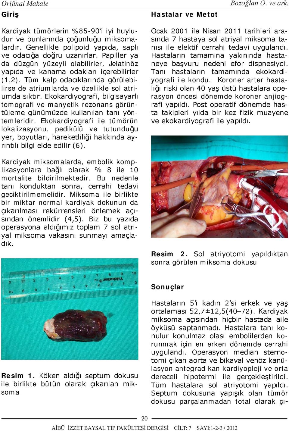 Ekokardiyografi, bilgisayarlı tomografi ve manyetik rezonans görüntüleme günümüzde kullanılan tanı yöntemleridir.