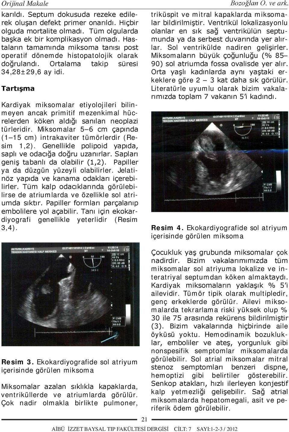 Tartışma Kardiyak miksomalar etiyolojileri bilinmeyen ancak primitif mezenkimal hücrelerden köken aldığı sanılan neoplazi türleridir.