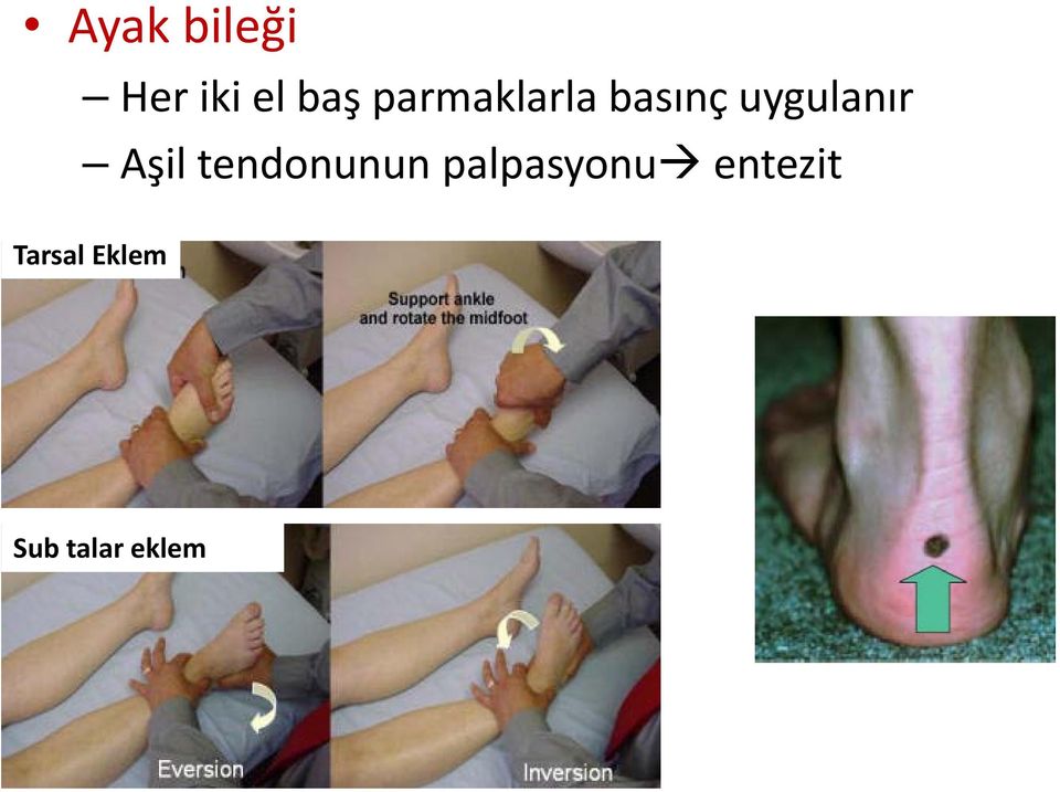 Aşil tendonunun palpasyonu