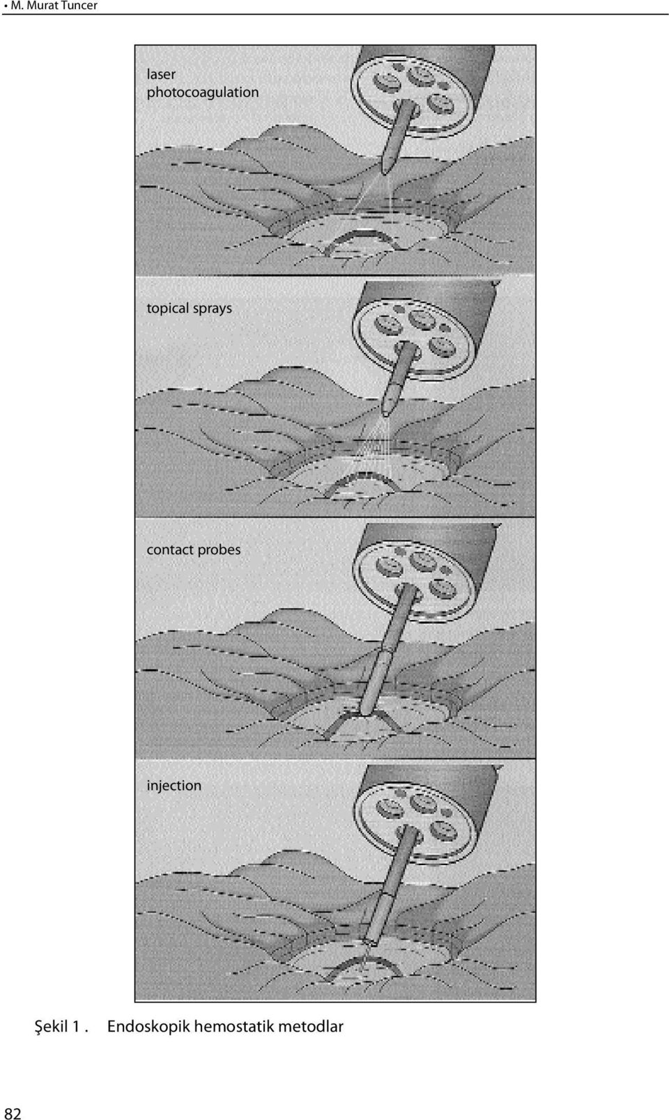 sprays contact probes