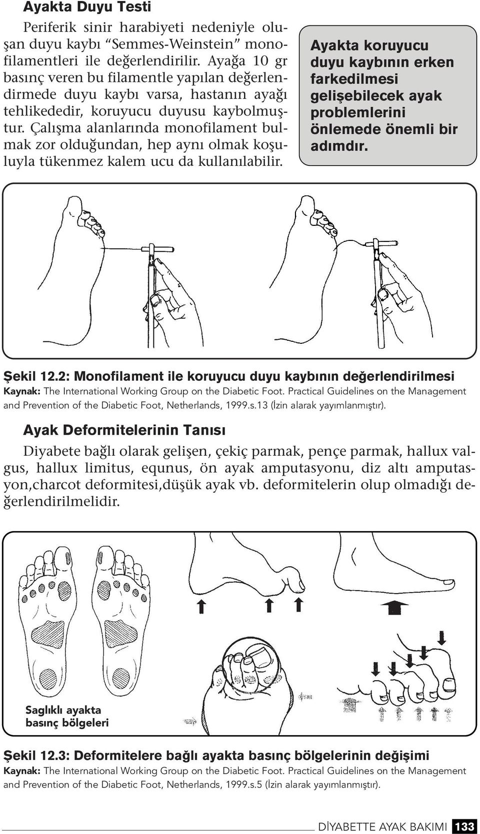 Çalışma alalarıda moofilamet bulmak zor olduğuda, hep ayı olmak koşuluyla tükemez kalem ucu da kullaılabilir.