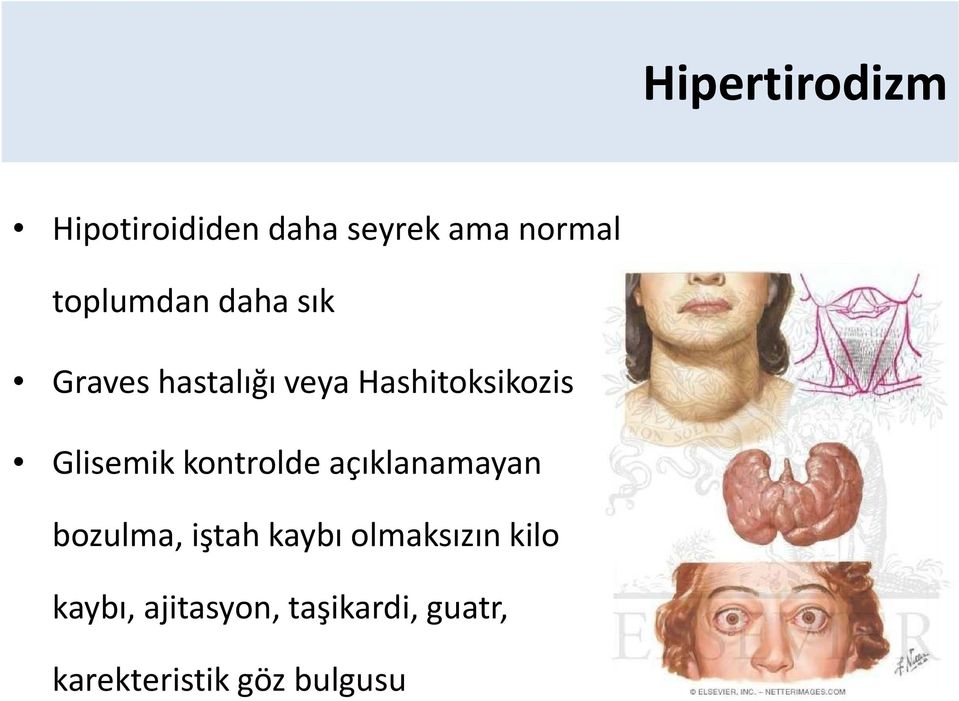 Glisemikkontrolde açıklanamayan bozulma, iştah kaybı