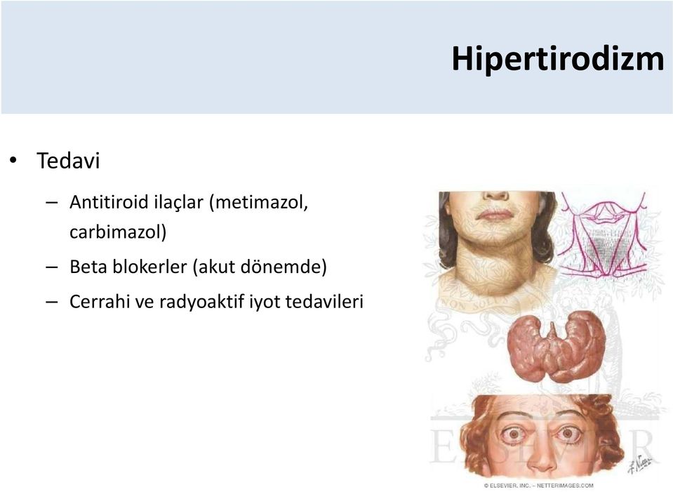 carbimazol) Beta blokerler(akut