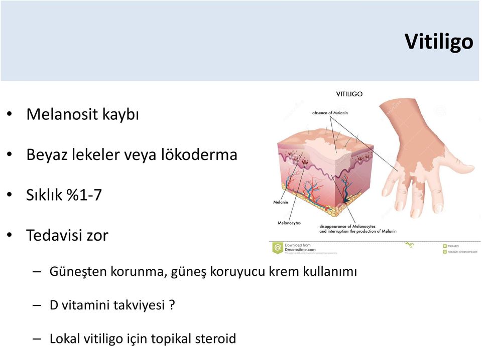 korunma, güneş koruyucu krem kullanımı D