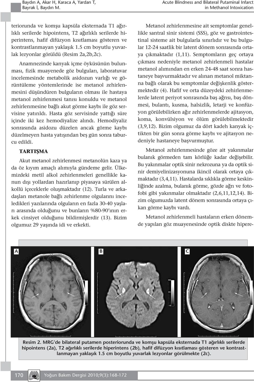 Anamnezinde kanyak içme öyküsünün bulunması, fizik muayenede göz bulguları, laboratuvar incelemesinde metabolik asidozun varlığı ve görüntüleme yöntemlerinde ise metanol zehirlenmesini düşündüren