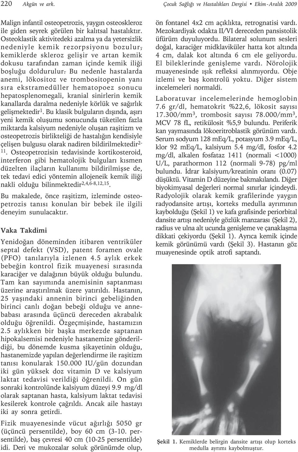 Bu nedenle hastalarda anemi, lökositoz ve trombositopenin yanı sıra ekstramedüller hematopoez sonucu hepatosplenomegali, kranial sinirlerin kemik kanallarda daralma nedeniyle körlük ve sağırlık