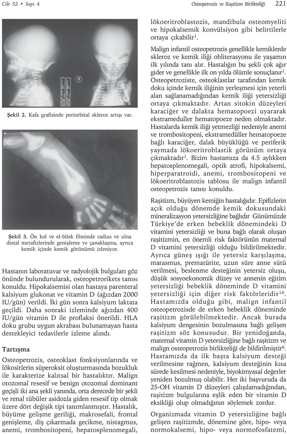 Hastanın laboratuvar ve radyolojik bulguları göz önünde bulundurularak, osteopetrorikets tanısı konuldu.