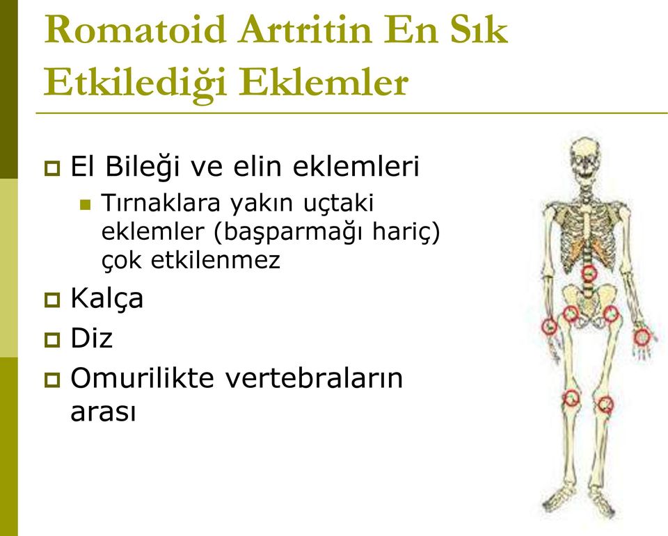 uçtaki eklemler (başparmağı hariç) çok