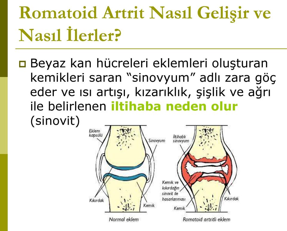 saran sinovyum adlı zara göç eder ve ısı artışı,