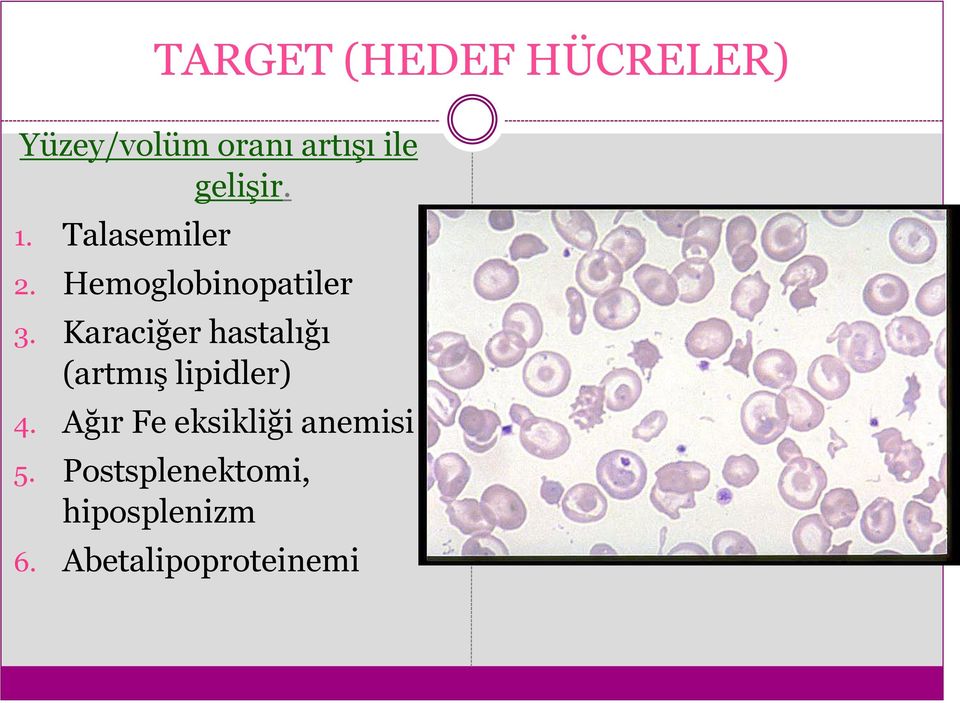 Karaciğer hastalığı (artmış lipidler) 4.