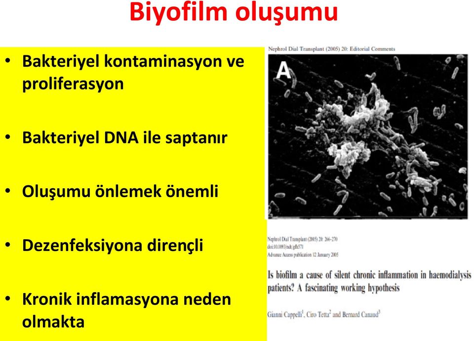 saptanır Oluşumu önlemek önemli