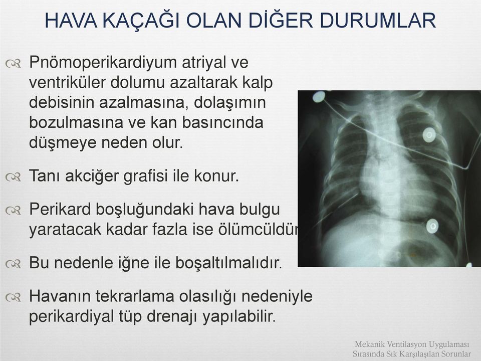 Perikard boşluğundaki hava bulgu yaratacak kadar fazla ise ölümcüldür. Bu nedenle iğne ile boşaltılmalıdır.