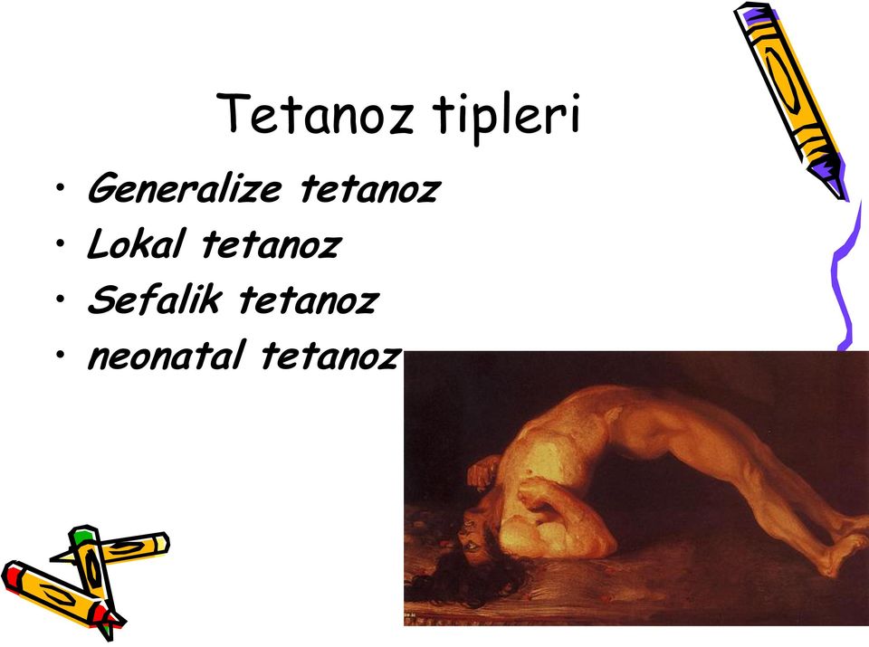 Lokal tetanoz