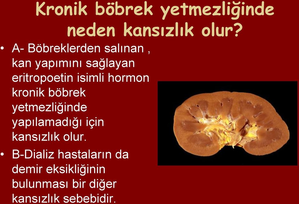 hormon kronik böbrek yetmezliğinde yapılamadığı için kansızlık