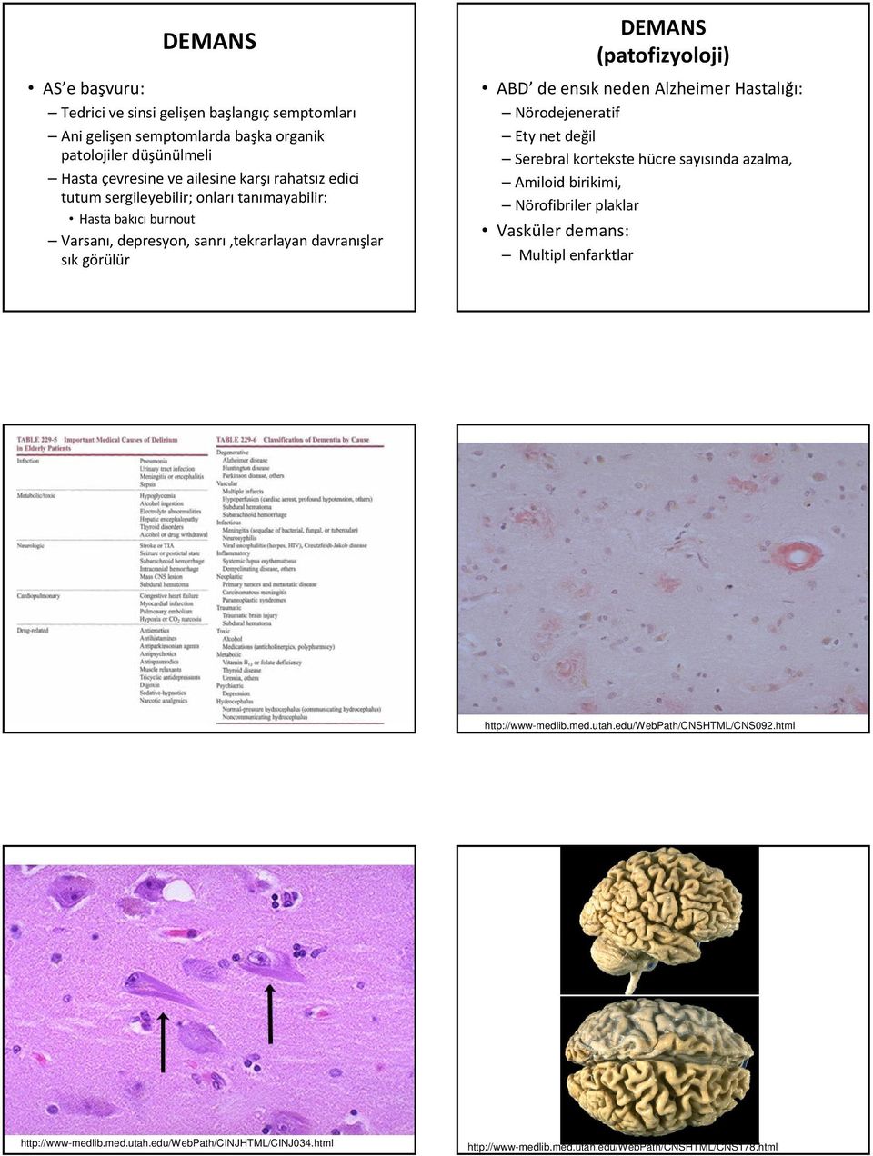 Hastalığı: Nörodejeneratif Ety net değil Serebral kortekste hücre sayısında azalma, Amiloid birikimi, Nörofibriler plaklar Vasküler demans: Multipl enfarktlar